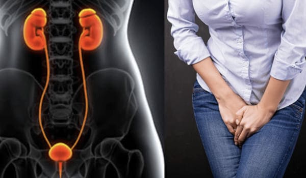 Infección en Vías Urinarias